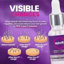 Episoft Hair Removal Serum